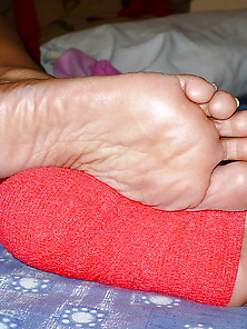 Bandage Of My Wife Feet