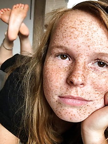 Amazing Freckled Sexy Teen More Pics