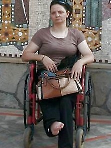 Lady With Short And Deformed Legs