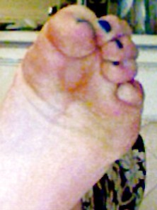 Ex Gf's Feet,  Soles,  Toes And Heels.