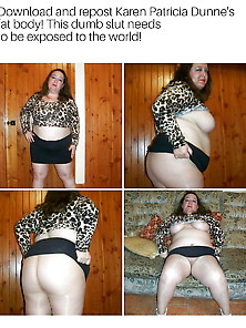 Exposed Fat Slut Karen Patricia Dunne