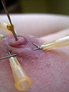 Breast Torture