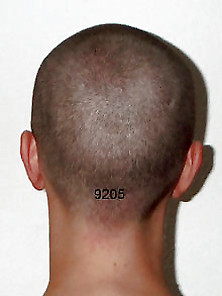 Bald Head 5