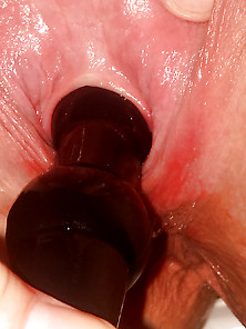 Anal Sex With Analbeads In My Peehole...