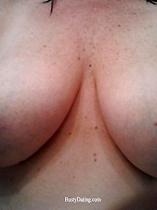 Busty Breast Reductions - Set 30