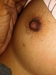 Hot Breast