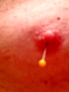 My Nipple Needle Play