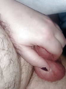 Wifes Butt Hole